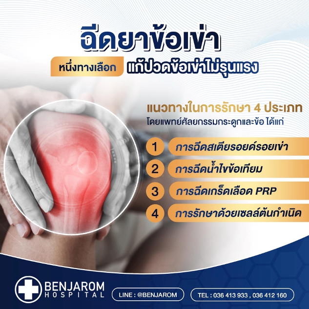 โปรแกรม BIO PRP รักษาข้อเข่า